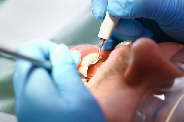 Best Emergency Broken Tooth Repair in Harbison Nyon, CA
