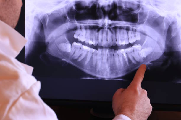  Harbison Nyon, CA Emergency Dentist Pros
