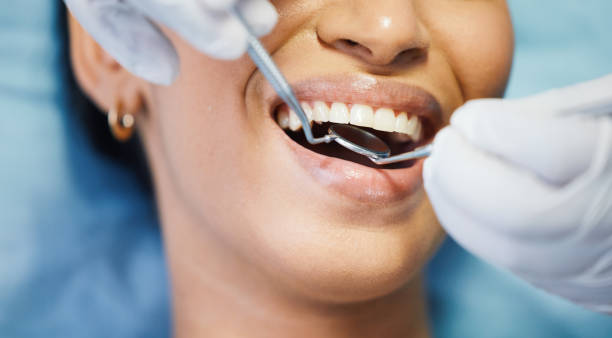 Best Emergency Wisdom Teeth Removal in Harbison Nyon, CA